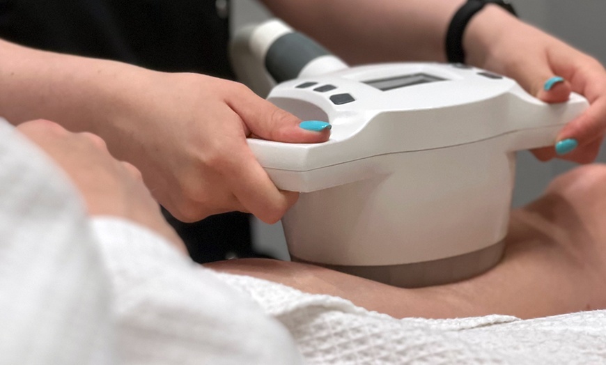 Image 4: Karty podarunkowe o różnej wartości na wybrane zabiegi kosmetyczne