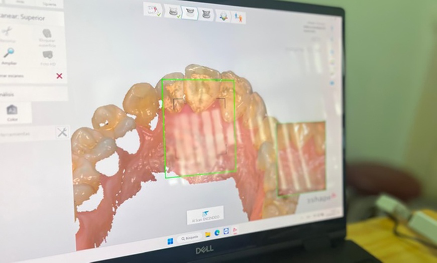 Image 4: Higiene bucal con pulido y limpieza de encías en hasta 4 cuadrantes 