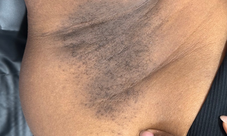 Image 8: Brazilian Waxing & Optional Eyebrow & Underarm Wax Combo
