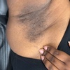Image 8: Brazilian Waxing & Optional Eyebrow & Underarm Wax Combo