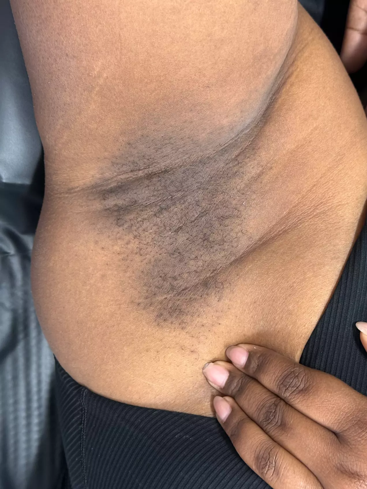 Brazilian Waxing & Optional Eyebrow & Underarm Wax Combo