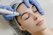 1, 2 o 3 sesiones de 40 minutos de radiofrecuencia facial Indiba rostro completo - Second Medium