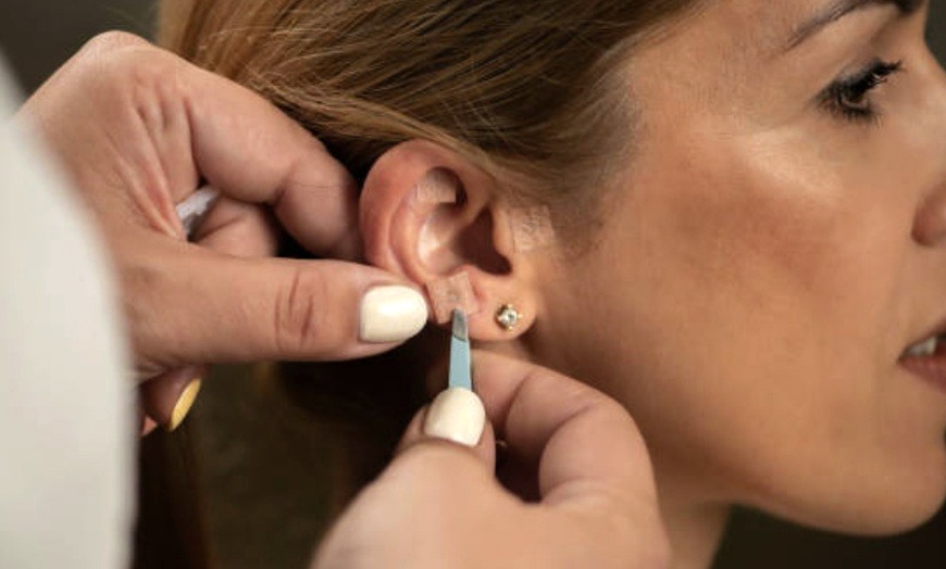 Image 6: Up to 45% Off on Facelift - Non-Surgical at Violet Wellness Spa by Tian Chao Herbs and Acupuncture