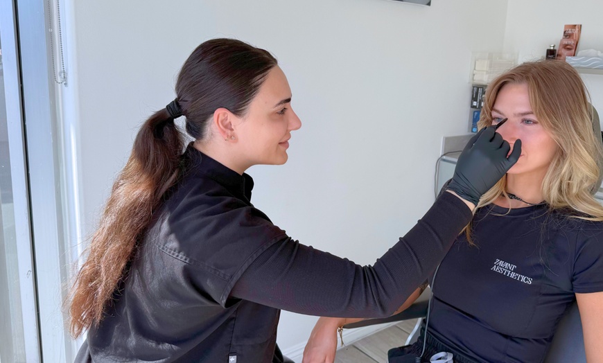 Image 2: Rejuvenate your Complexion with One V-Beam Laser Therapy!
