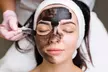 1, 2 o 3 sesiones de Hollywood peeling con mascarilla de carbón activo y láser hasta un 56% de descuento - Second Medium