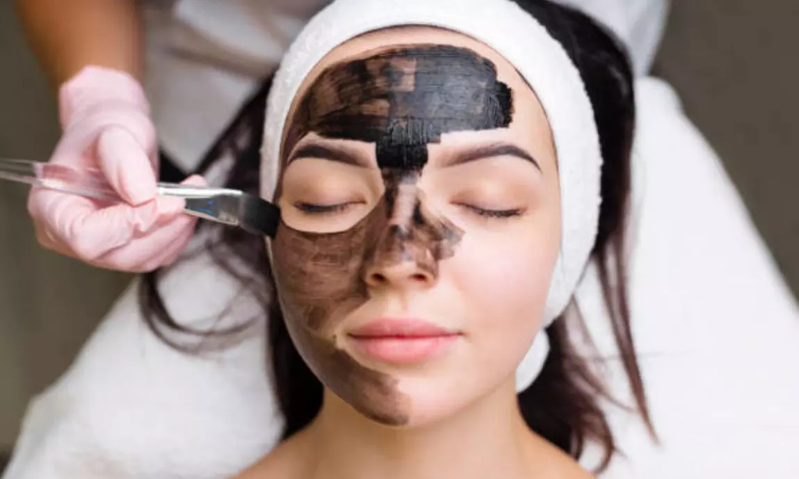 Hollywood peeling con mascarilla de carbón activo y láser