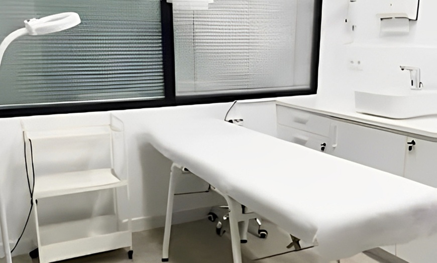 Image 11: 1, 2 o 4 sesiones de radiofrecuencia facial