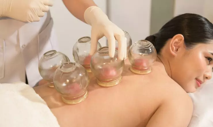 Relax and Rejuvenate with a Cupping Session 