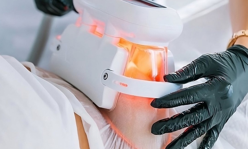 Image 3: 1 o 2 sesiones de 1 hora de criolipólisis doble con masaje drenante