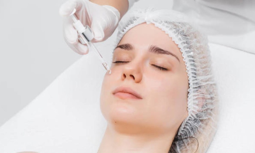 Image 3: Exosomas con Dermapen, 1 o 2 sesiones para renovación facial integral