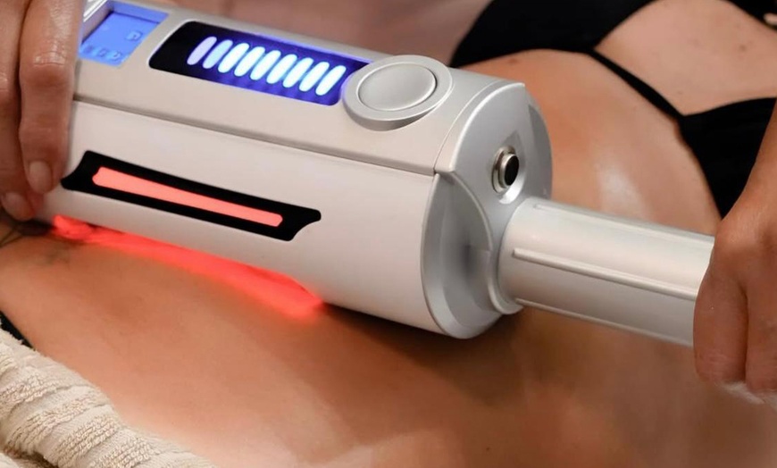 Image 2: 3, 5 o 7 sesiones de depilación láser diodo