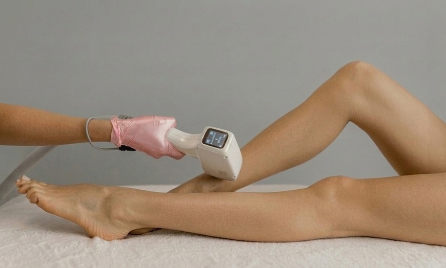 Image 3: Laser Hair Reduction: 3 or 6 Sessions for Small-Large Areas