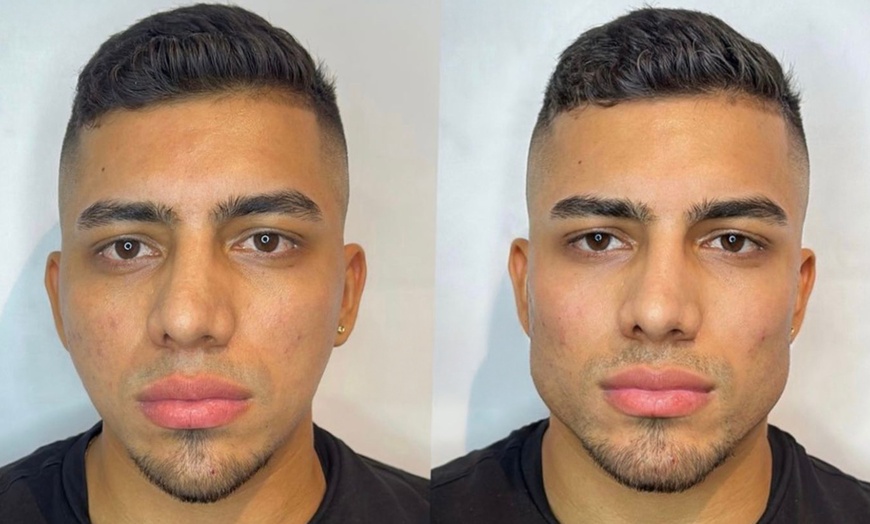 Image 2: Get Smooth Skin with 1, 2, or 3 Dark Circle / Under Eye Treatments