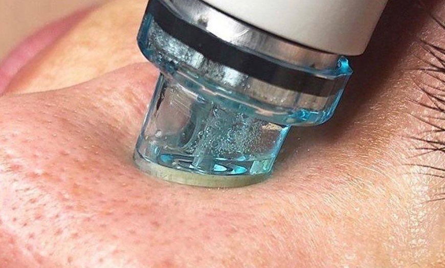 Image 4: Gesichtsbehandlung „Classic“, Hydrogen-Behandlung oder BB Glow