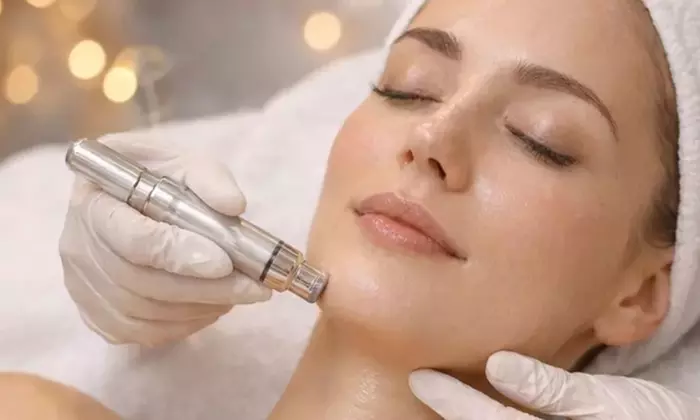 90 Min. Aqua-Facial & kosmetisches Microneedling für 1 Person