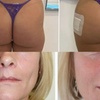 Image 1: Up to 57% Off on Injection Sculptra at Age Well Dr Labs