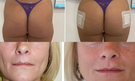 1/2 Vial (4.5 CC) of Sculptra for Face - Age Well Dr/Labs