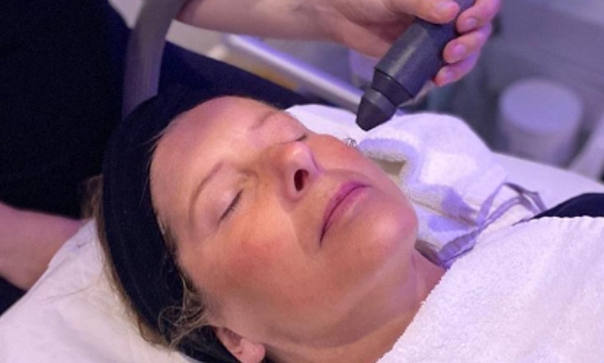 Image 1: Up to 51% Off on Facial at Cryojuvenate Uk