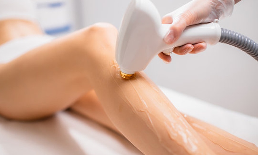 Image 2: Laser Hair Removal Sessions