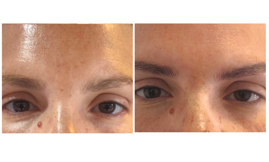 Image 7: Sesión de microblading de cejas pelo a pelo con opción a retoque 