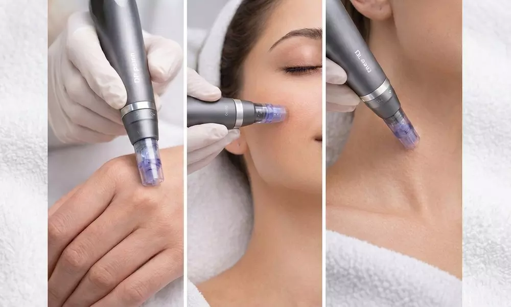 One Microneedling Session with 3 Complimentary Red Light Therapy at All Glow Med Spa (Up to 4% Off)
