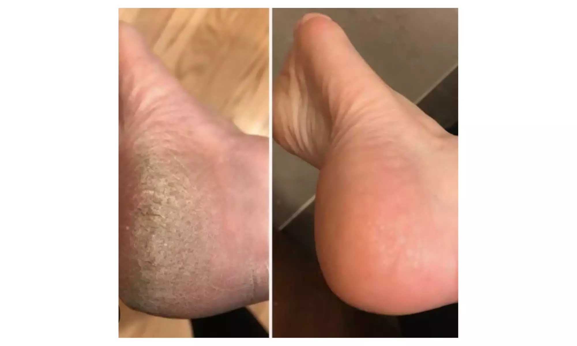 Spa Pedicure with Steaming or Jelly Mask or Paraffin Wax on Hand & Leg