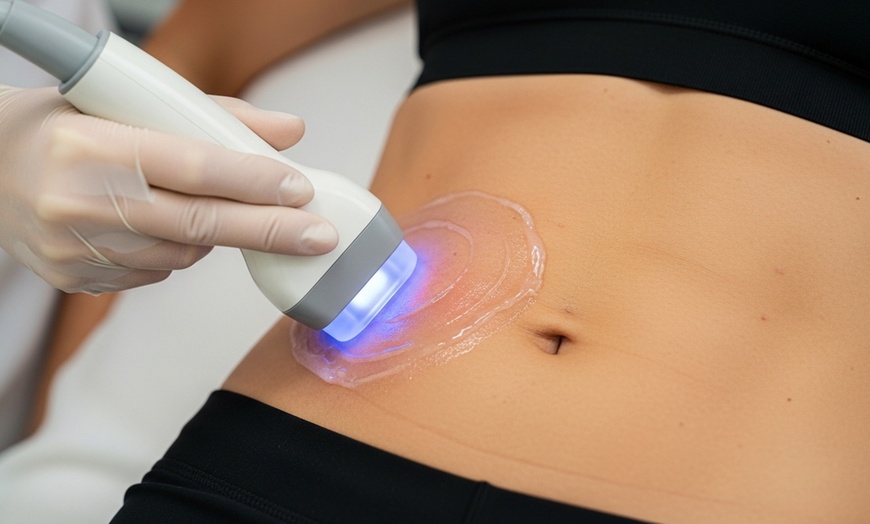 Image 1: Ultrasound Cavitation or Non Invasive Skin Tightening Abdomen 