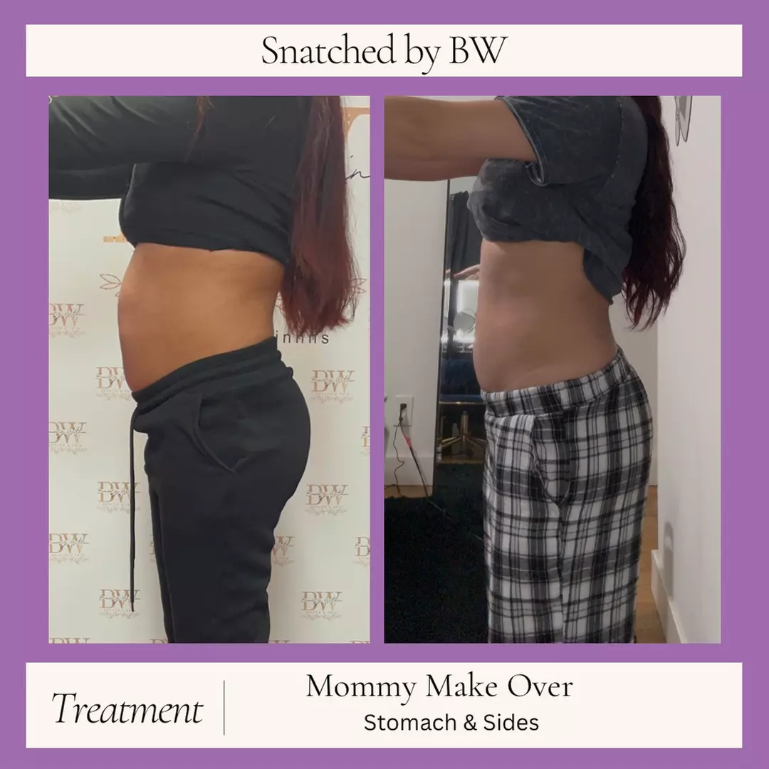 One, Three, or Six Mommy Makeover Sessions or Snatched To The Max