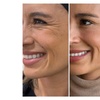 Image 4: Up to 47% Off Botox and Juvéderm at AK Medical Spa
