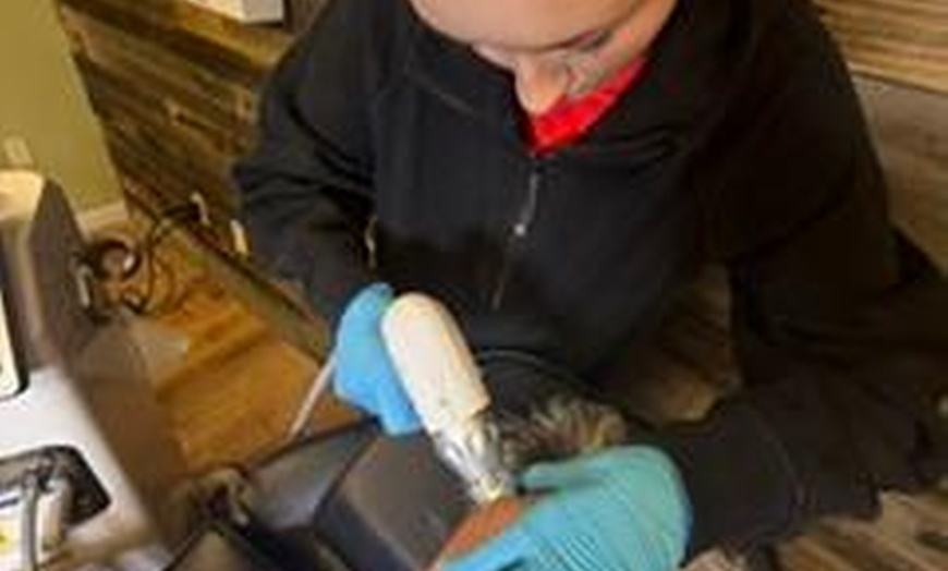 Image 3: Enhance Your Skin with Microneedling and RF Treatment Session