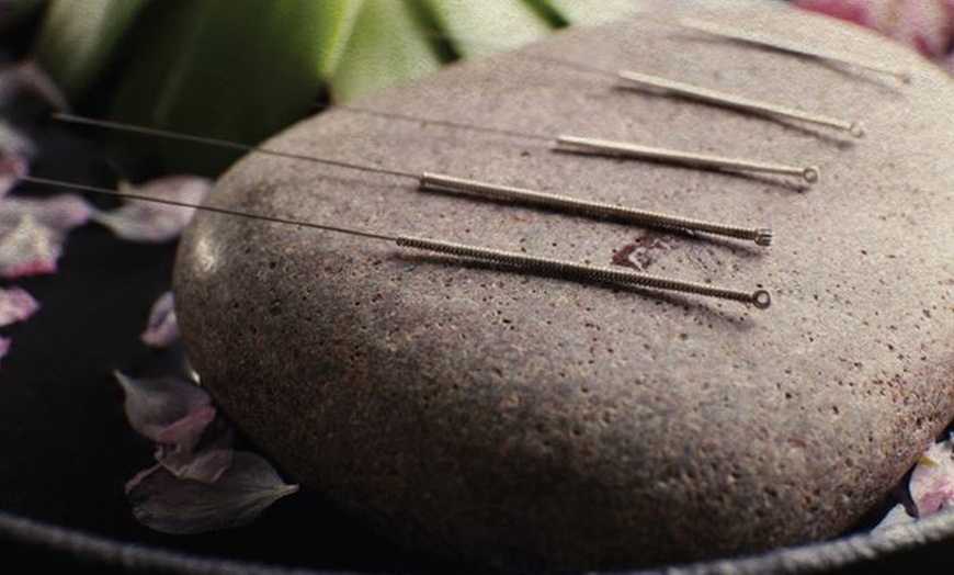 Image 4: Natürliches Facelifting: 1 oder 2 Anti-Aging-Akupunktur-Behandlungen 