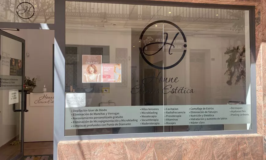 Tratamiento HIFU en cara completa, y opción a cuello o papada