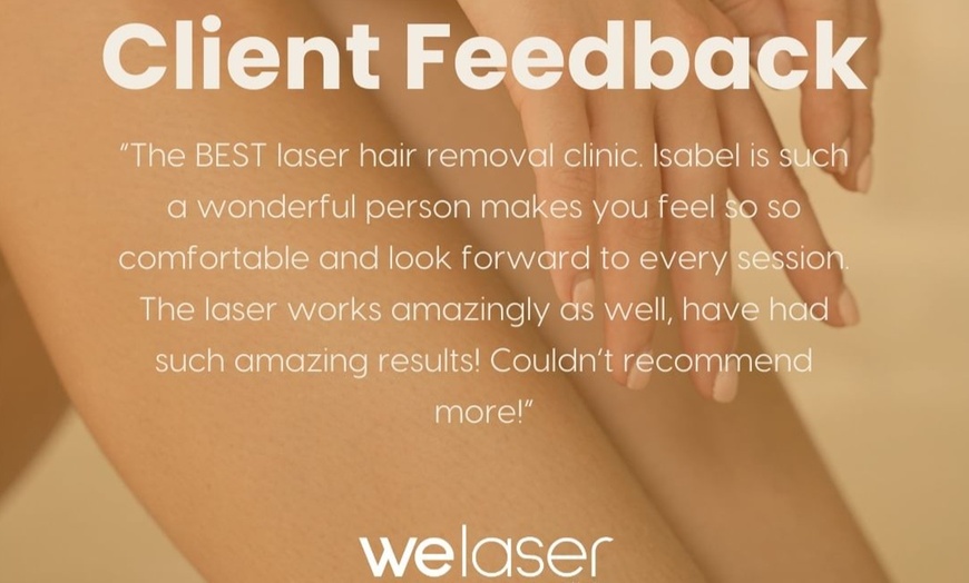 Image 3: Six Sessions of Laser Hair Removal on Small, Medium, or Large Areas