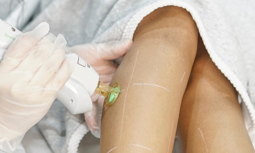 Image 3: Smooth, Hair-Free Skin with Laser Hair Removal at Bared Monkey