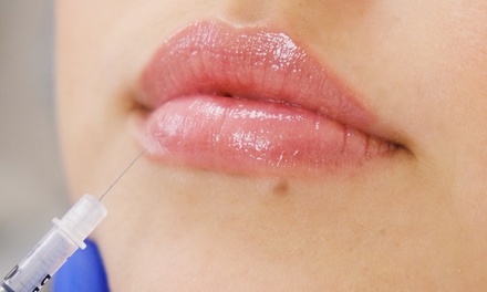 One Syringe of Restylane L - LoveLand Med Spa