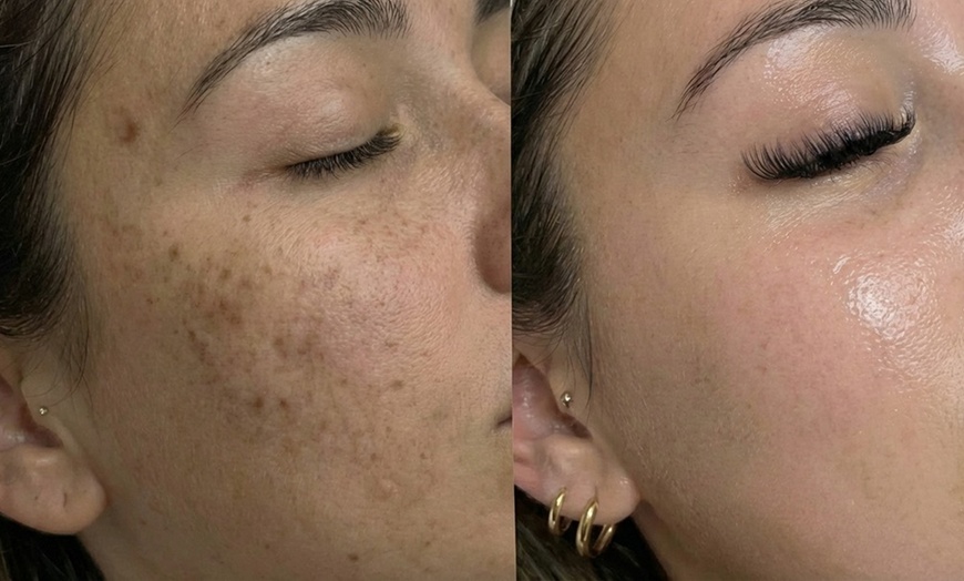 Image 20: Unifiez votre teint avec un soin anti-taches ciblé 5G Removal