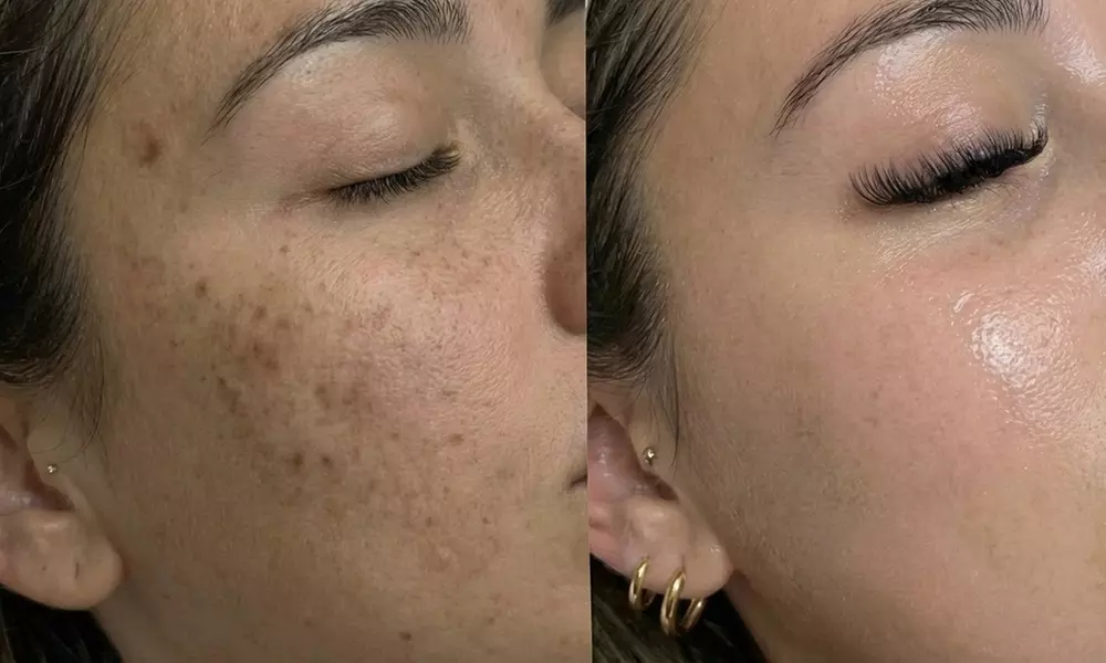 Unifiez votre teint avec un soin anti-taches ciblé 5G Removal