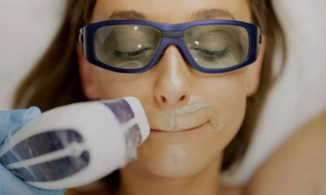 Dauerhafte Haarentfernung mit 3-Wellen-Diodenlaser für Mann und Frau