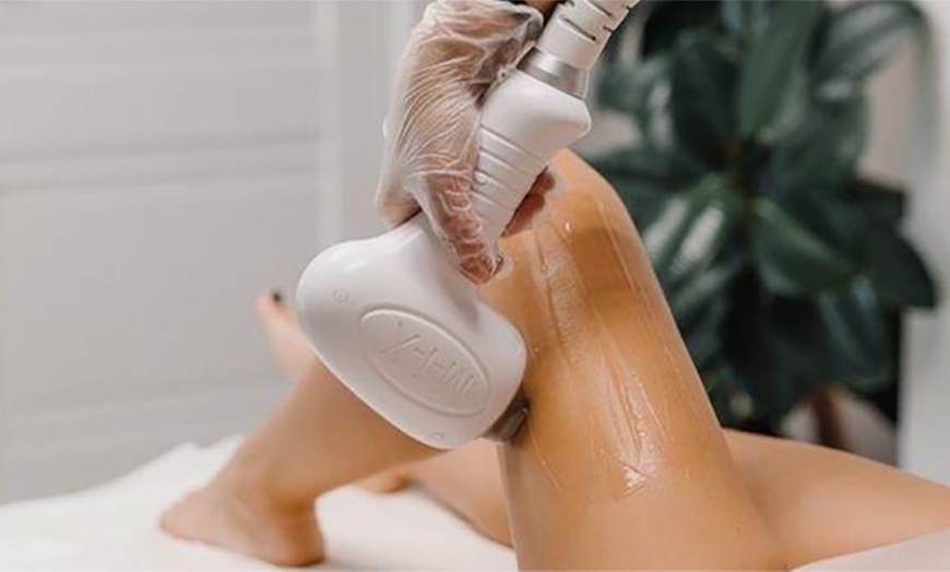 Image 1: Épilation laser Beauty by JL : 5 séances pour une peau lisse