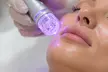 Advanced Non-Surgical Face, Neck & Body Lift OR HIFU Glow Facial with Korean & LED Light Therapy (Up to 89% Off) - Second Medium