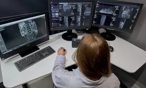 Do 27% zniżki na Rezonans magnetyczny w Rezonans FC