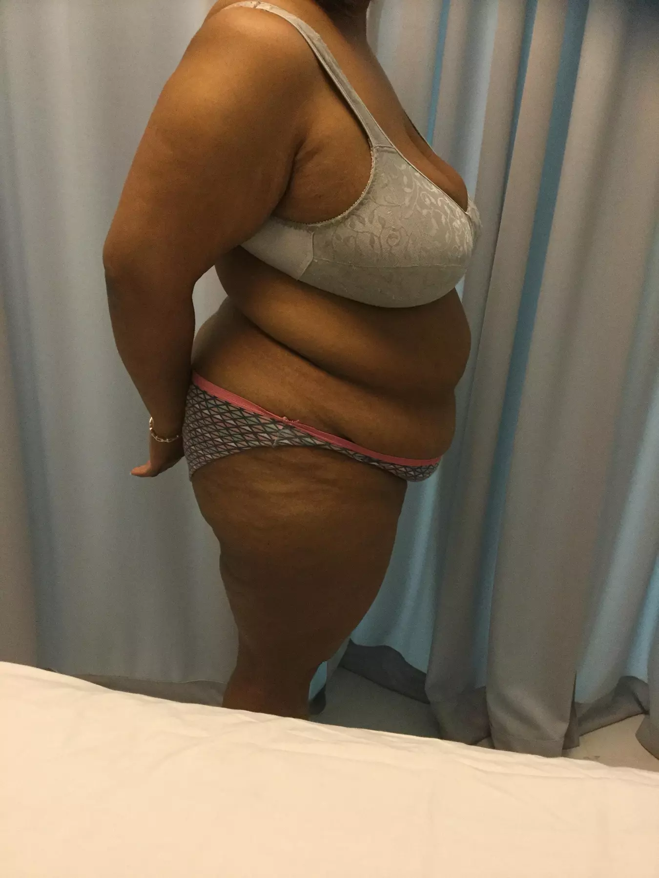 Up to 43% Off on Laser Lipo Treatments at Massage World Medspa