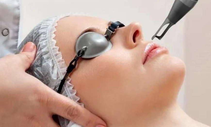 Image 3: Revitalise Your Complexion with Luxury Laser & Skin Facials