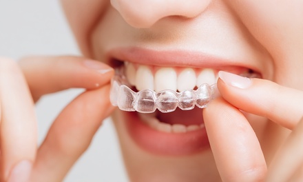 All-Inclusive Clear Aligner Treatment with free teeth whitening kit - Smilewave Aligners & Braces