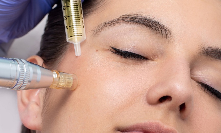 Image 1: 1 o 2 sesiones de Dermapen facial con vitaminas para 1 persona 