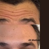 Image 2: Smooth & Plump: Botox and Juvéderm Custom Aesthetic Packages