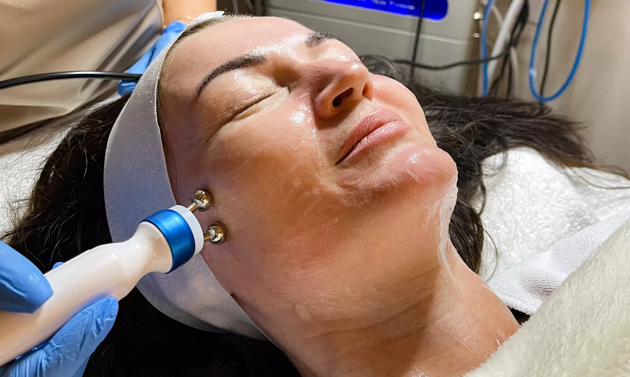 Transform Your Skin with 90-Minute Micro-Needling Sessions
