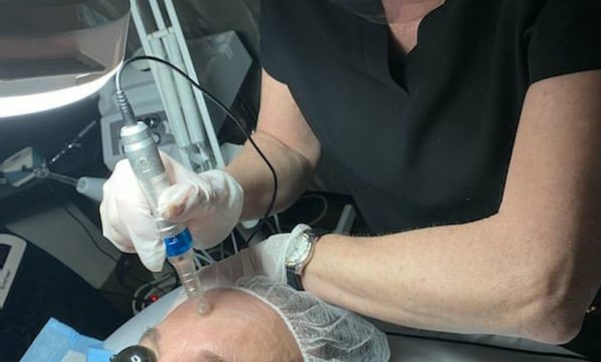Image 2: Revitalize Your Skin: Microneedling, LED Light Therapy 
