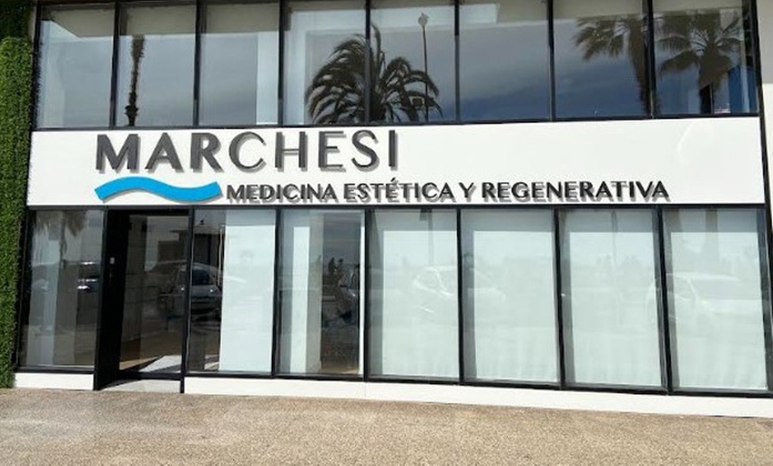 Image 3: 1 o 2 sesiones de dermapen facial con vitaminas para una persona