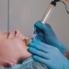 Image 1: 1 o 2 sesiones de exosomas con dermapen en rostro con limpieza facial 